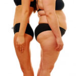 hcg injections before and after